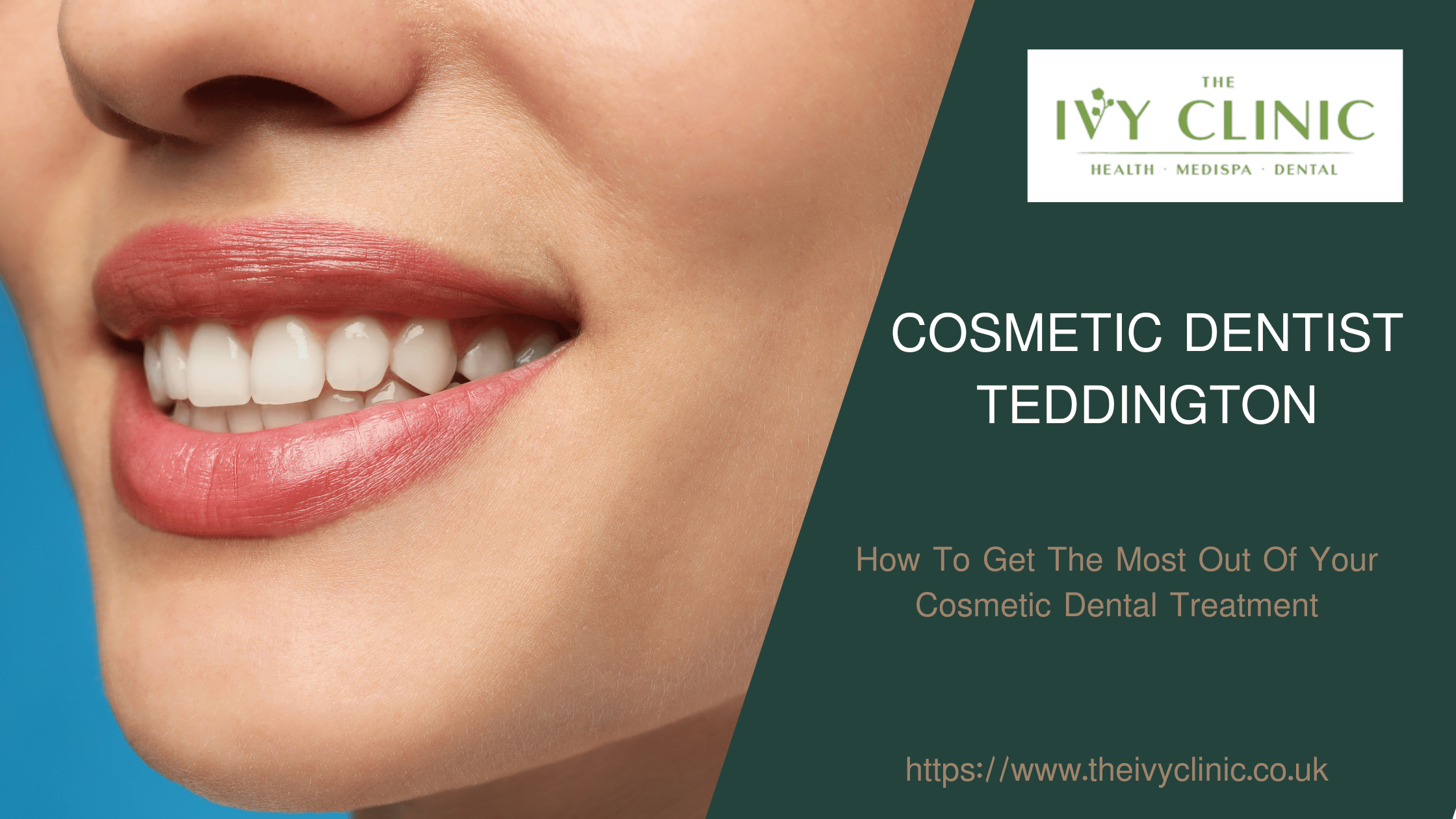 Cosmetic Dentist Teddington