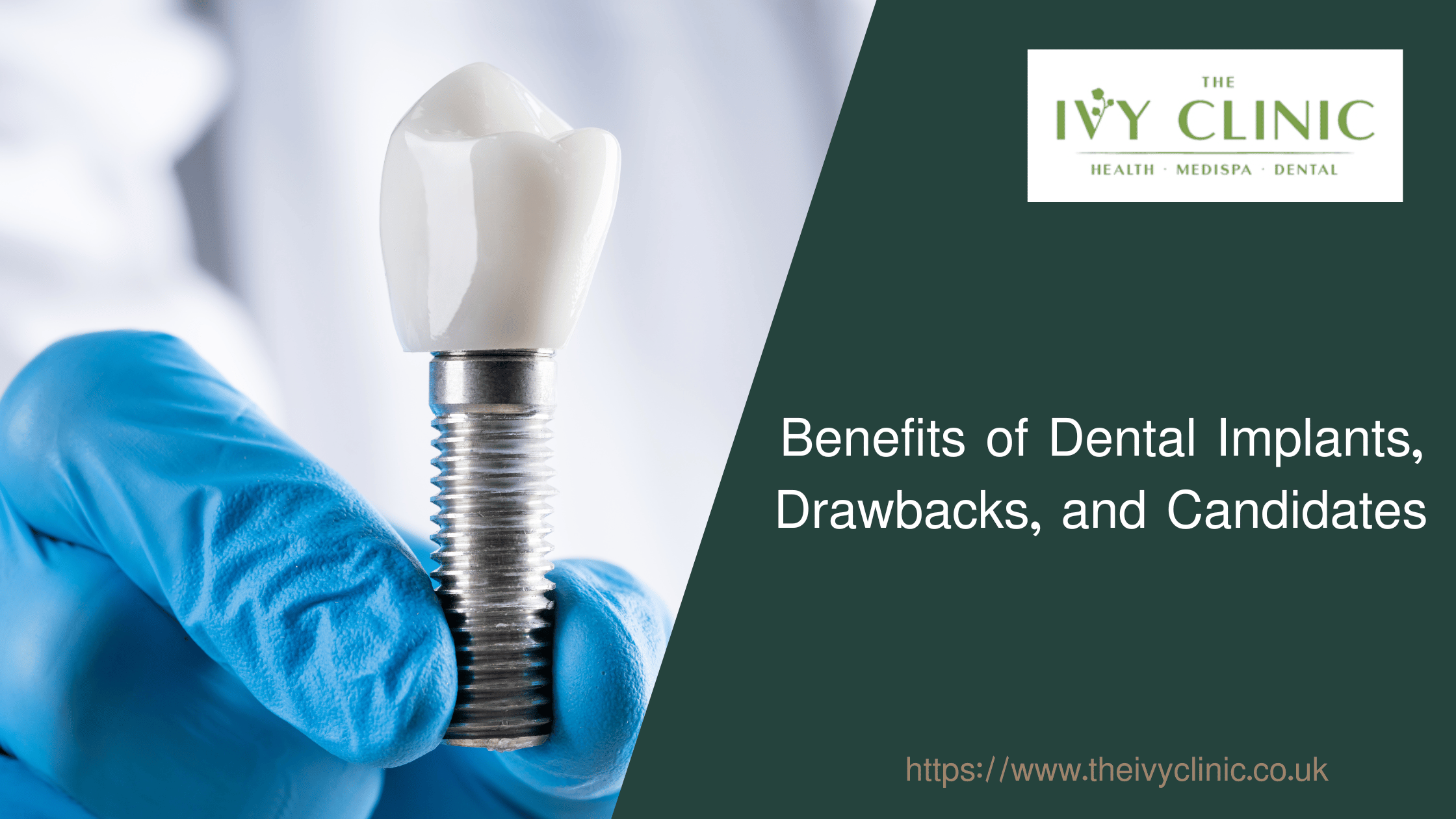 Benefits Of Dental Implants, Drawbacks, And Candidates